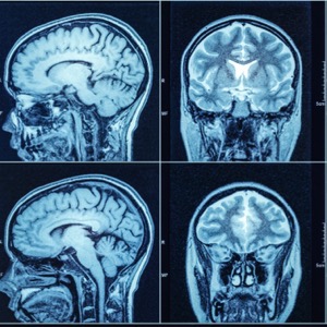 Neurochirurgická ambulance
