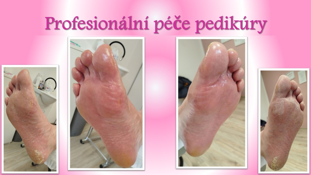 Pedikúra & Manikúra LKŠ foto 5