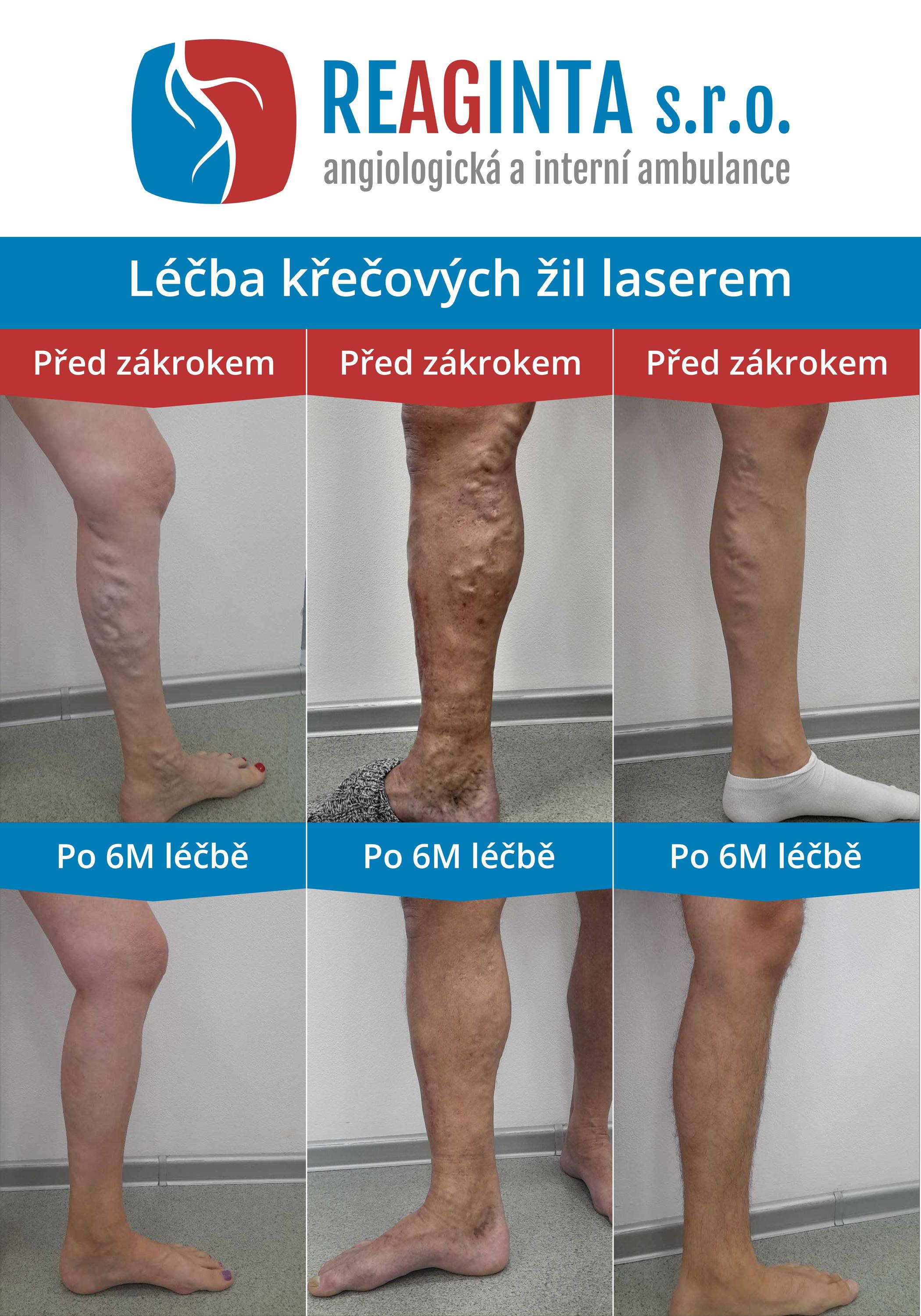 Cévní ambulance - REAGINTA s.r.o. foto 2