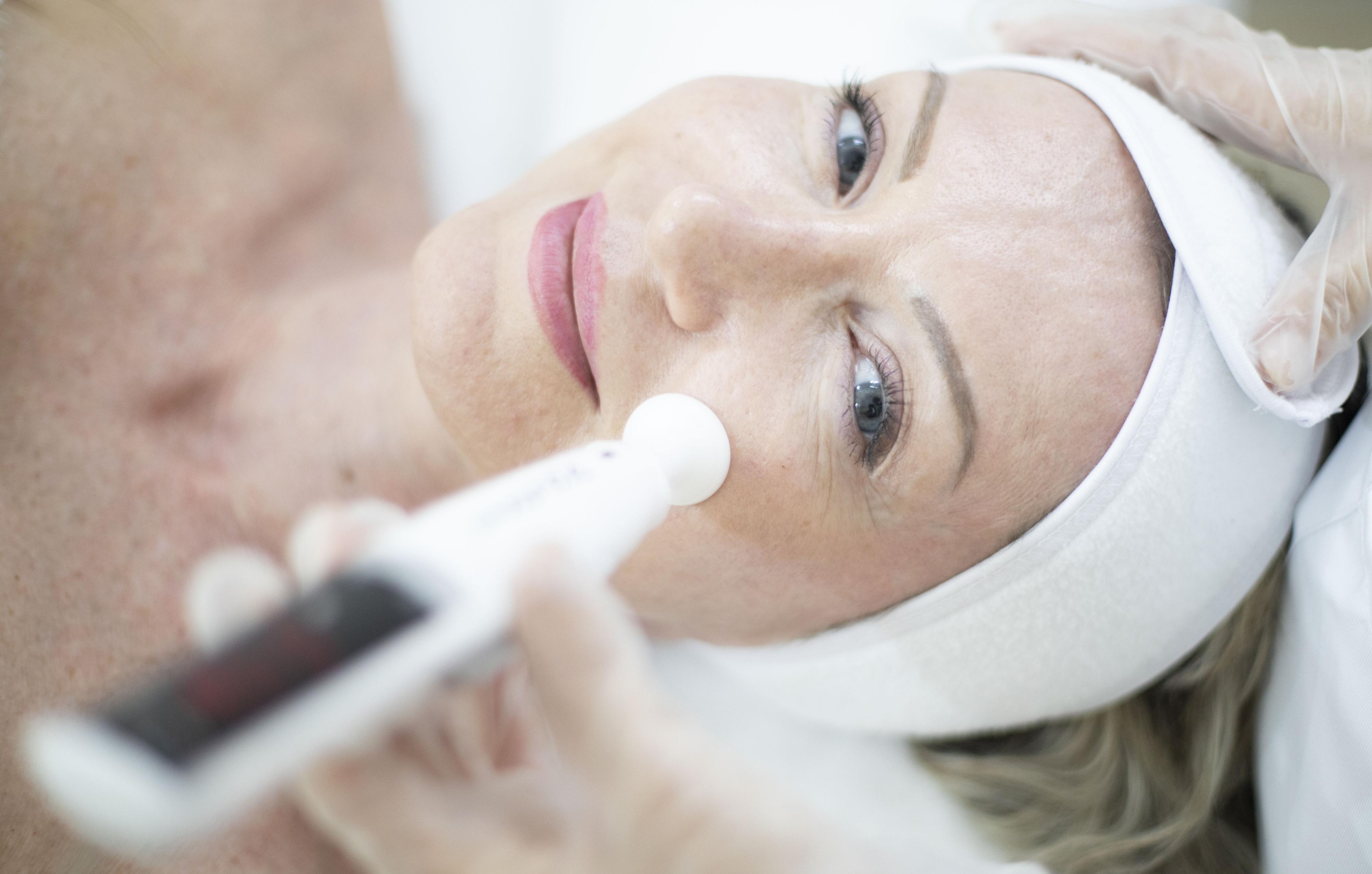 Ošetření studenou plazmou