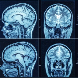 Neurology practices and clinics