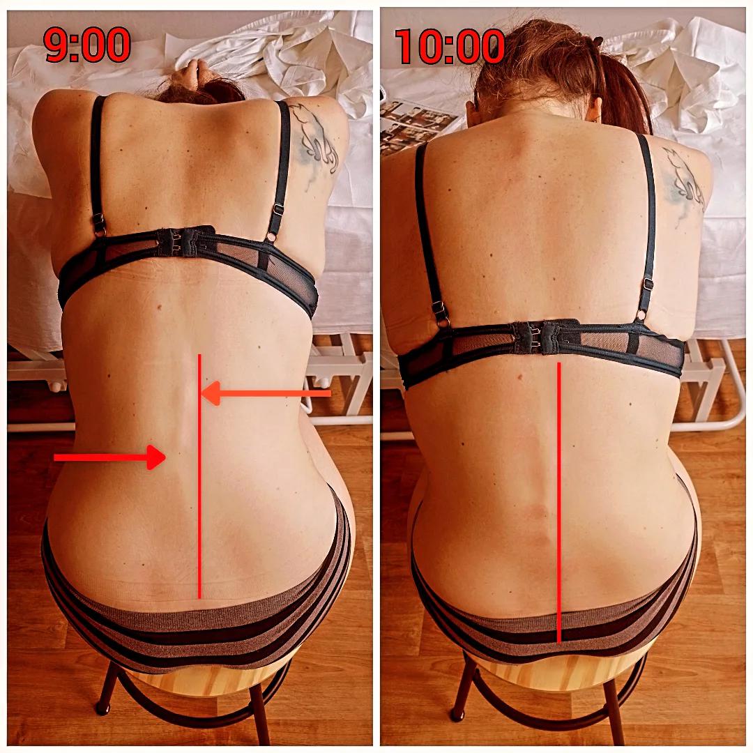 Dornovka Dan – Dornova metoda Plus & Formthotics foto 4