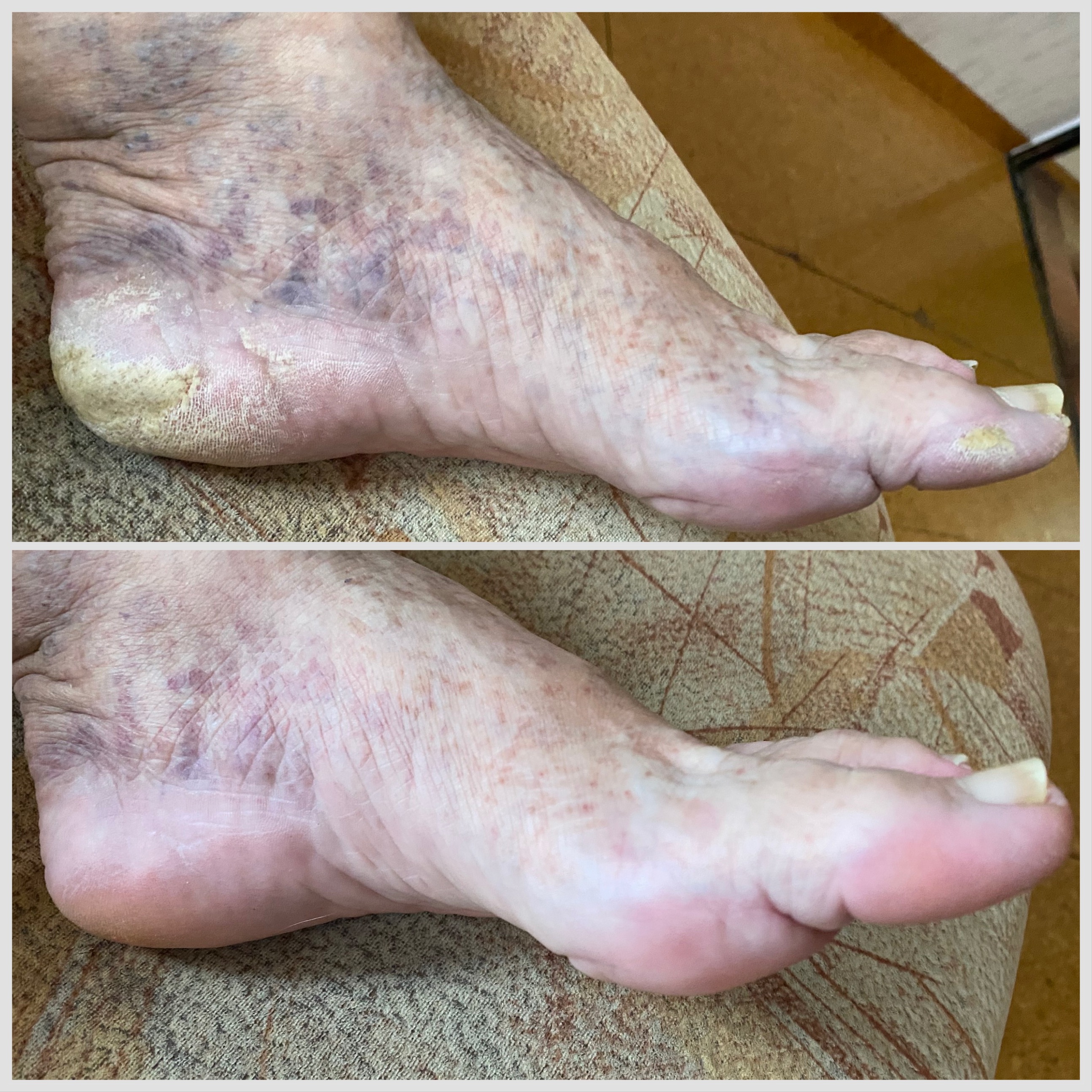 Pedikúra Eliška Škrabalová foto 2