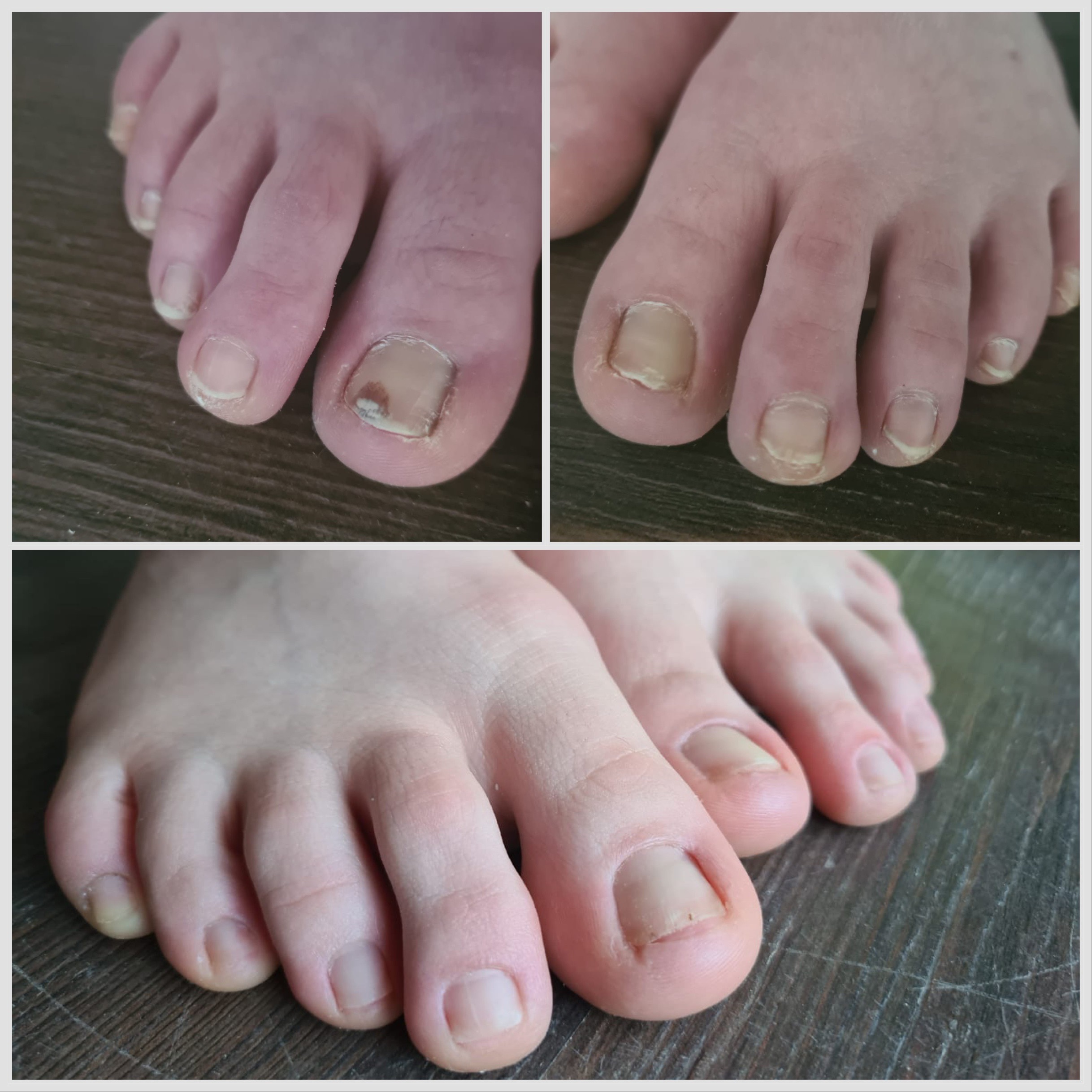 Pedikúra Eliška Škrabalová foto 4