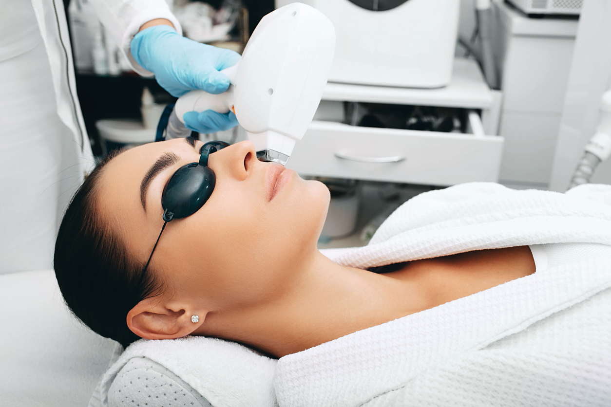 Laserová epilace obličeje