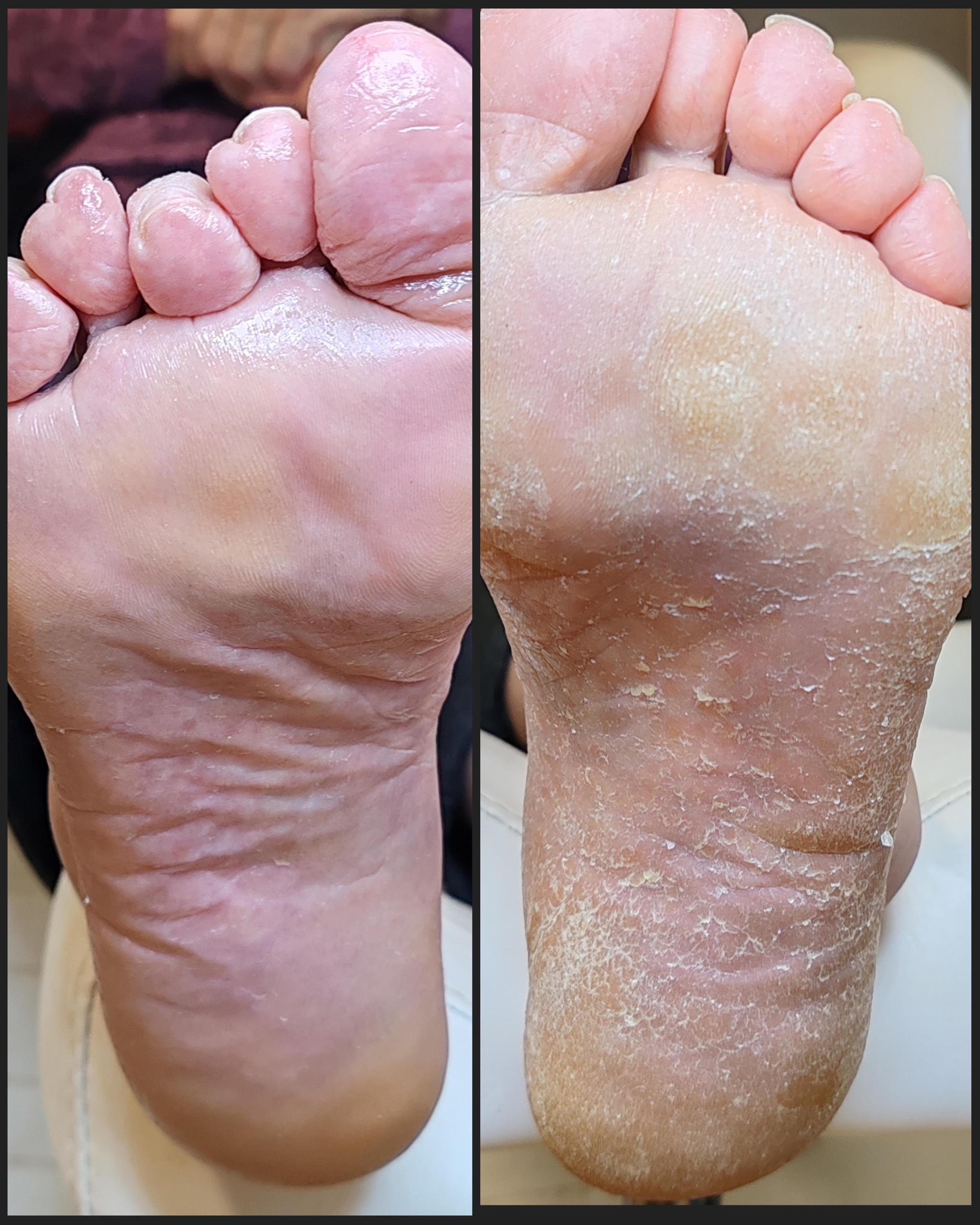 Pedikúra - Bc. Jana Hamralová foto 4