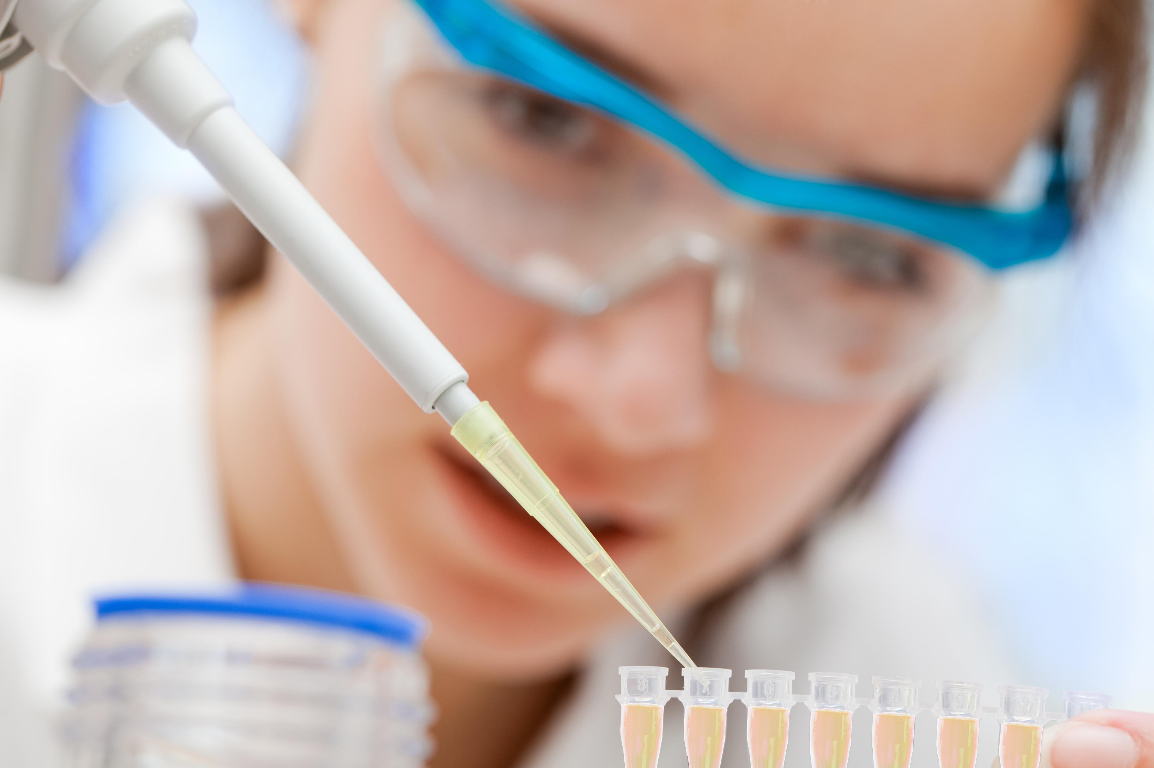 odběry krve AGELLAB