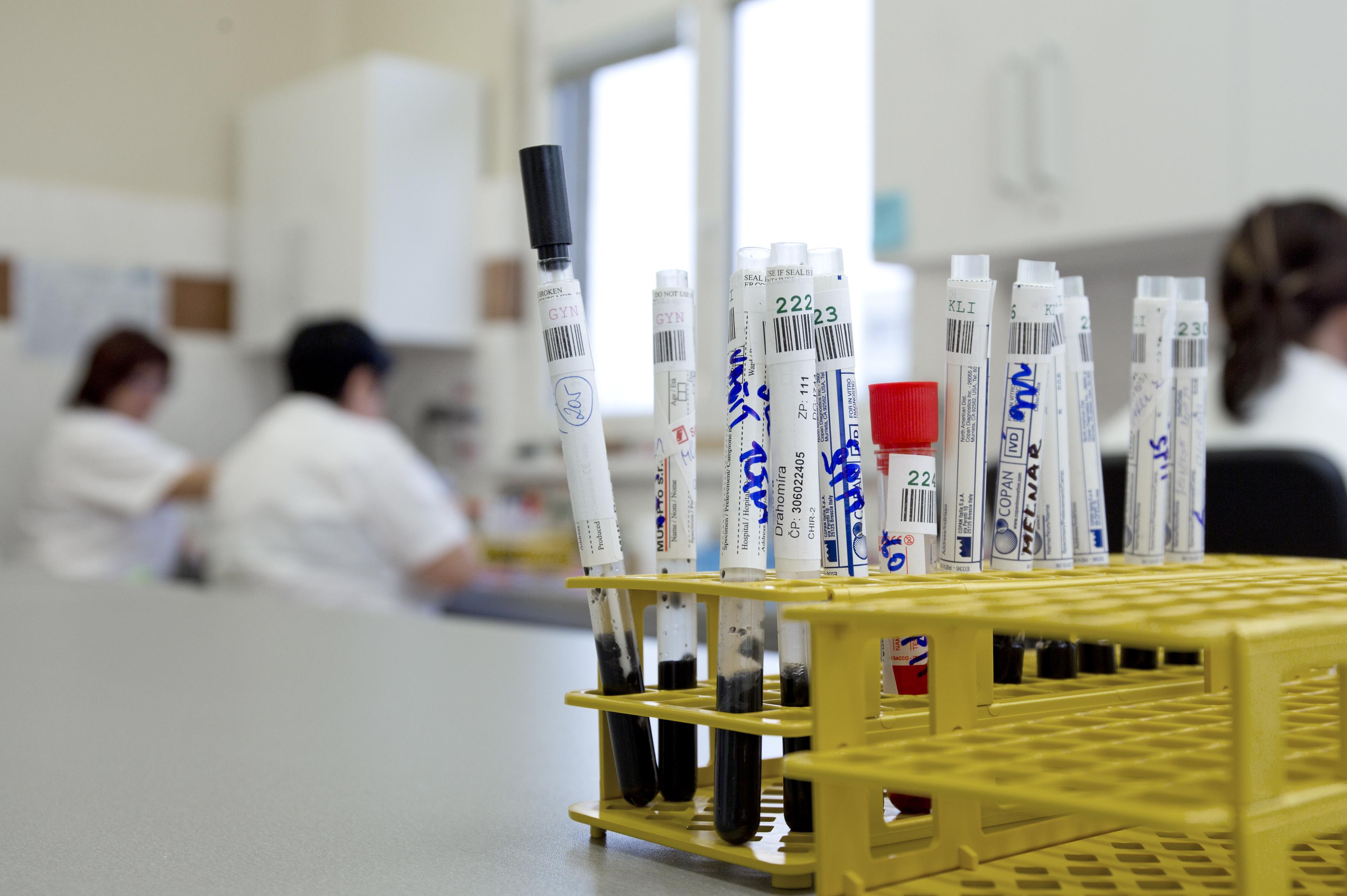 odběry krve AGELLAB foto 1