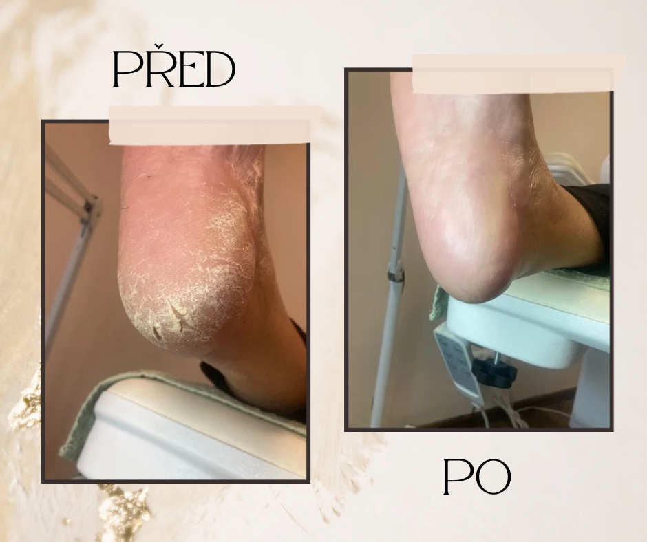 Pedikúra - Spokojené nohy Marie Vlasáková foto 3