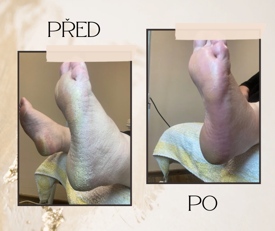 Pedikúra - Spokojené nohy Marie Vlasáková foto 4