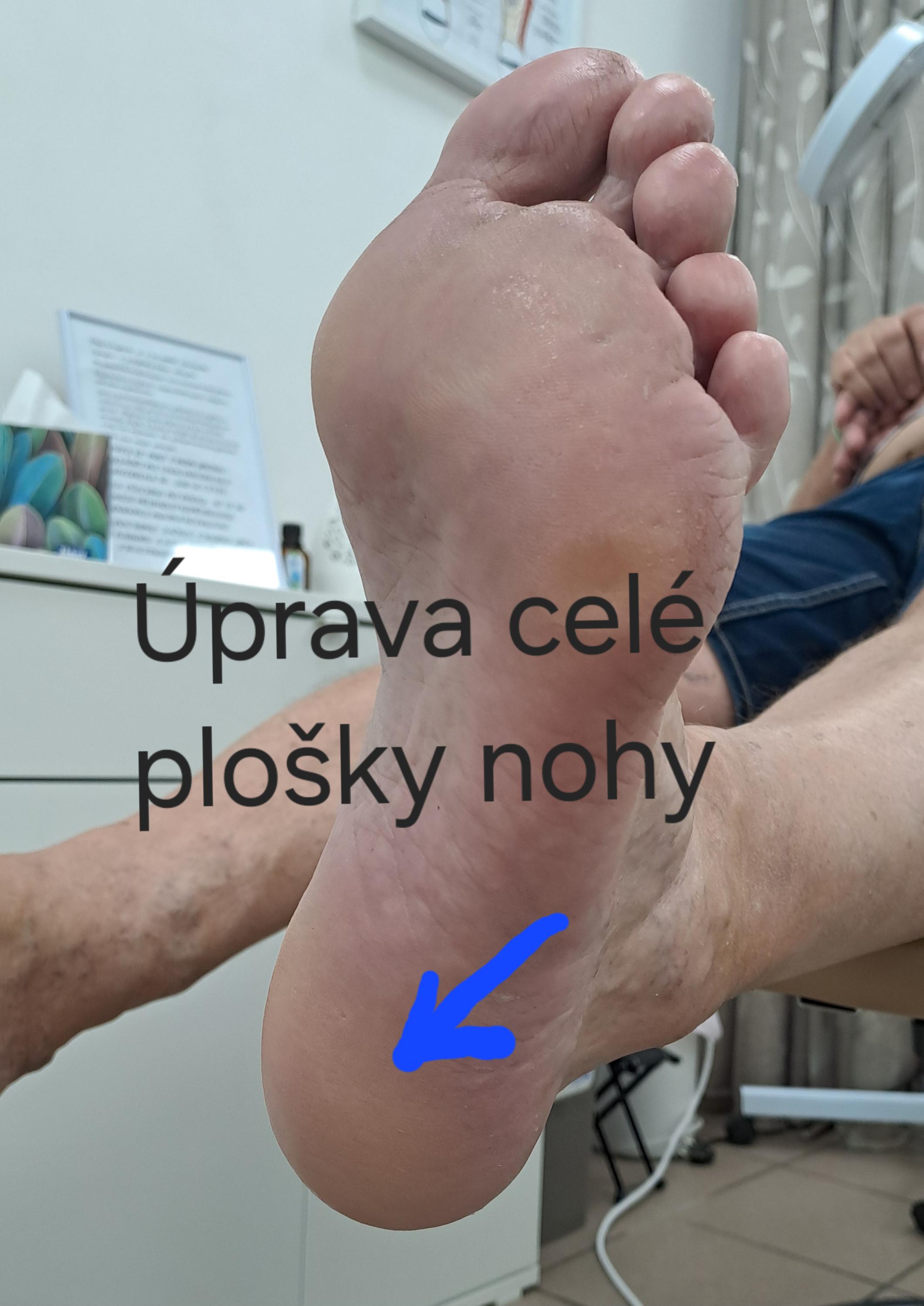 Pedikúra Michaela foto 6