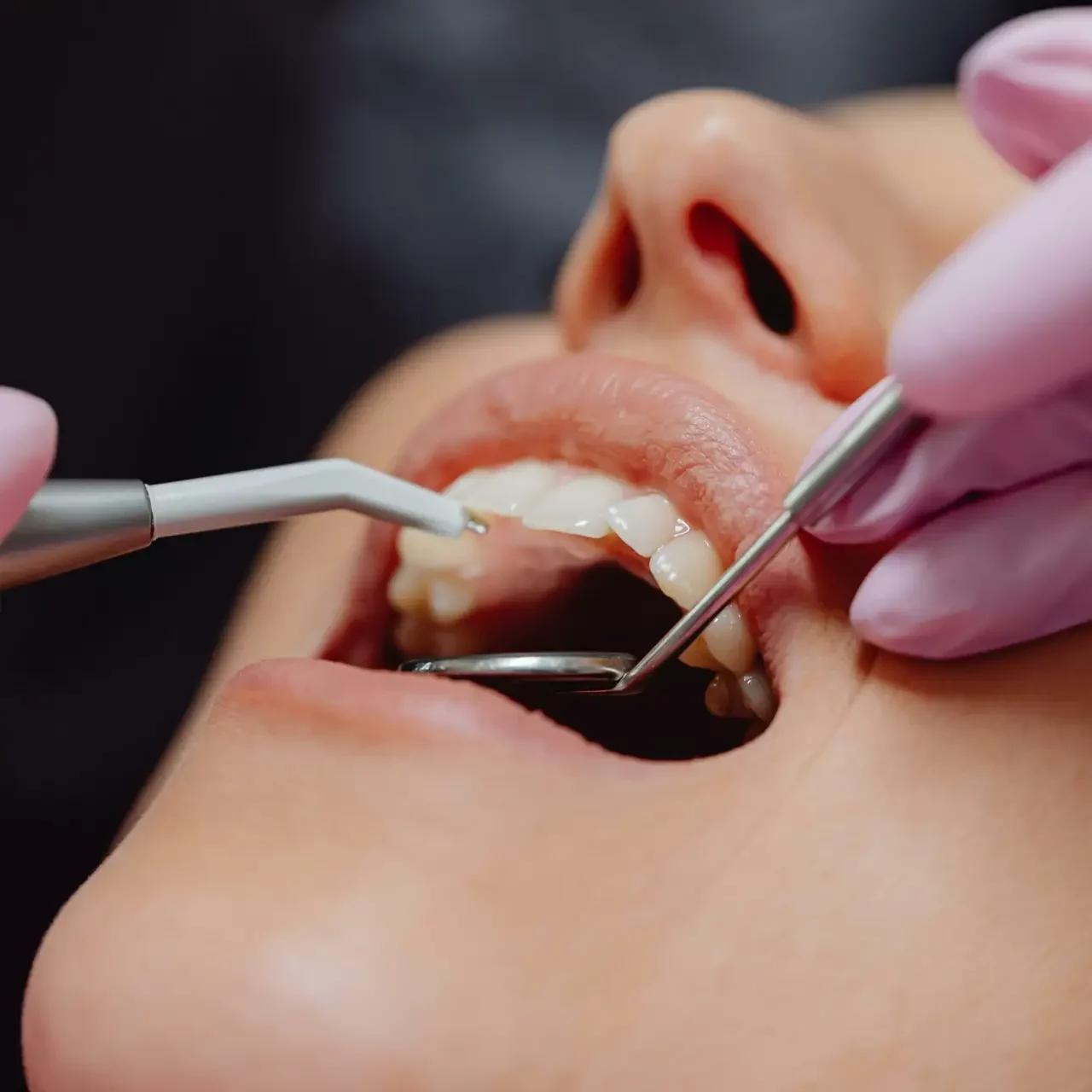 Stomatologie MarieDent – MDDr. Maria Štiller foto 4