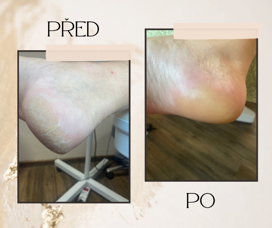 Pedikúra - Spokojené nohy Marie Vlasáková foto 6