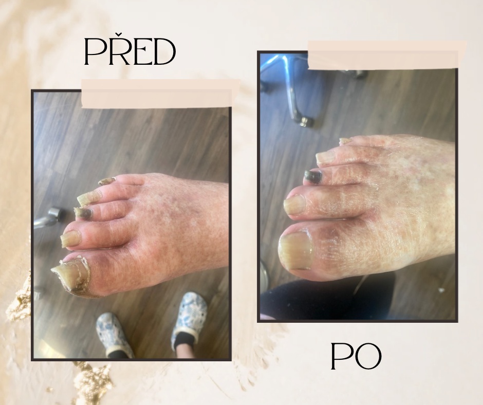 Pedikúra - Spokojené nohy Marie Vlasáková foto 2