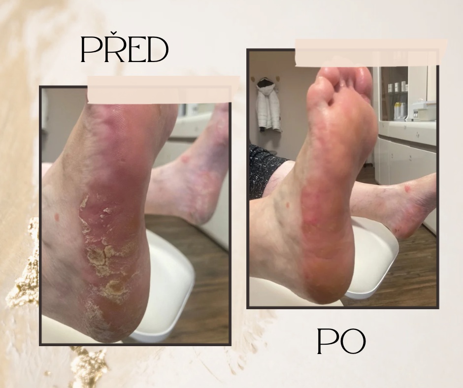 Pedikúra - Spokojené nohy Marie Vlasáková foto 5