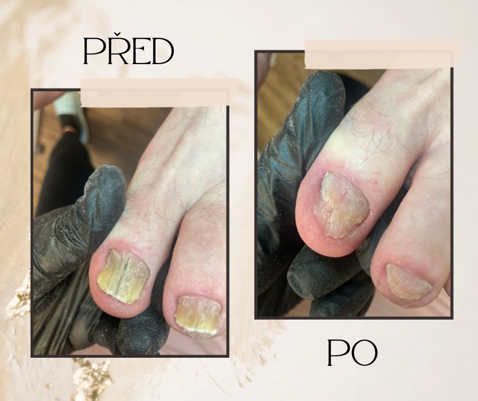 Pedikúra - Spokojené nohy Marie Vlasáková foto 1