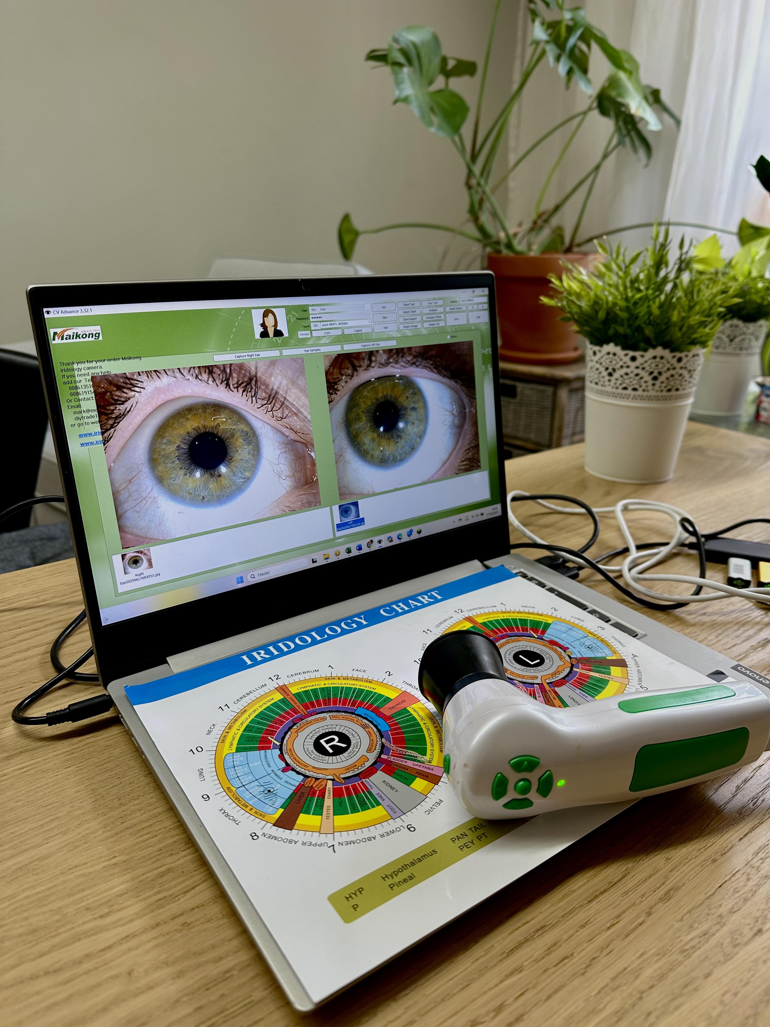 Nezávazné poradenství Irisdiagnostika