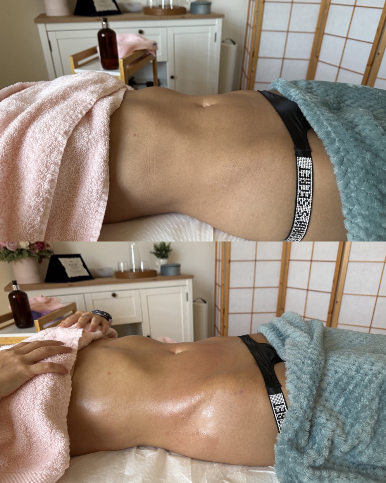 Kateřina Rösslerová - Maderoterapie & Masáže foto 3