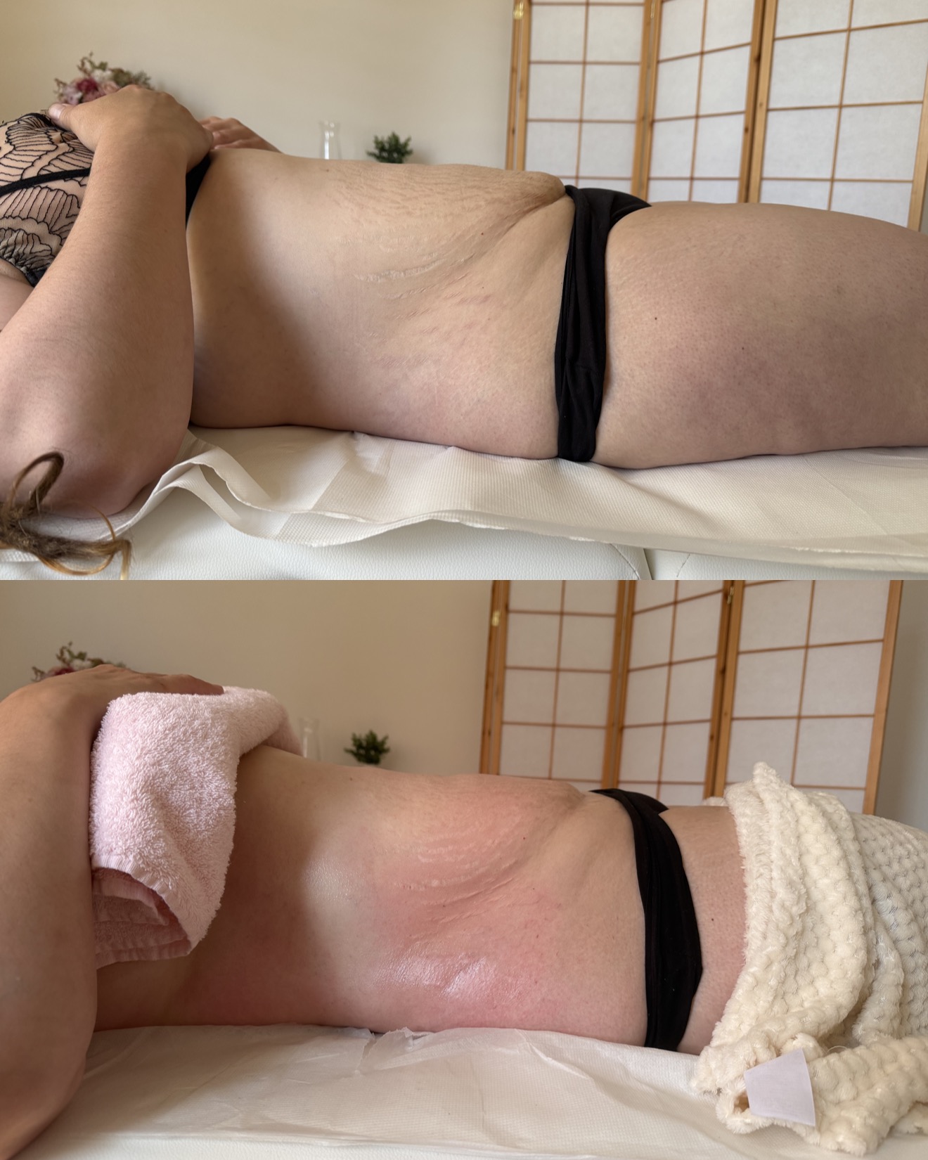 Kateřina Rösslerová - Maderoterapie & Masáže foto 3