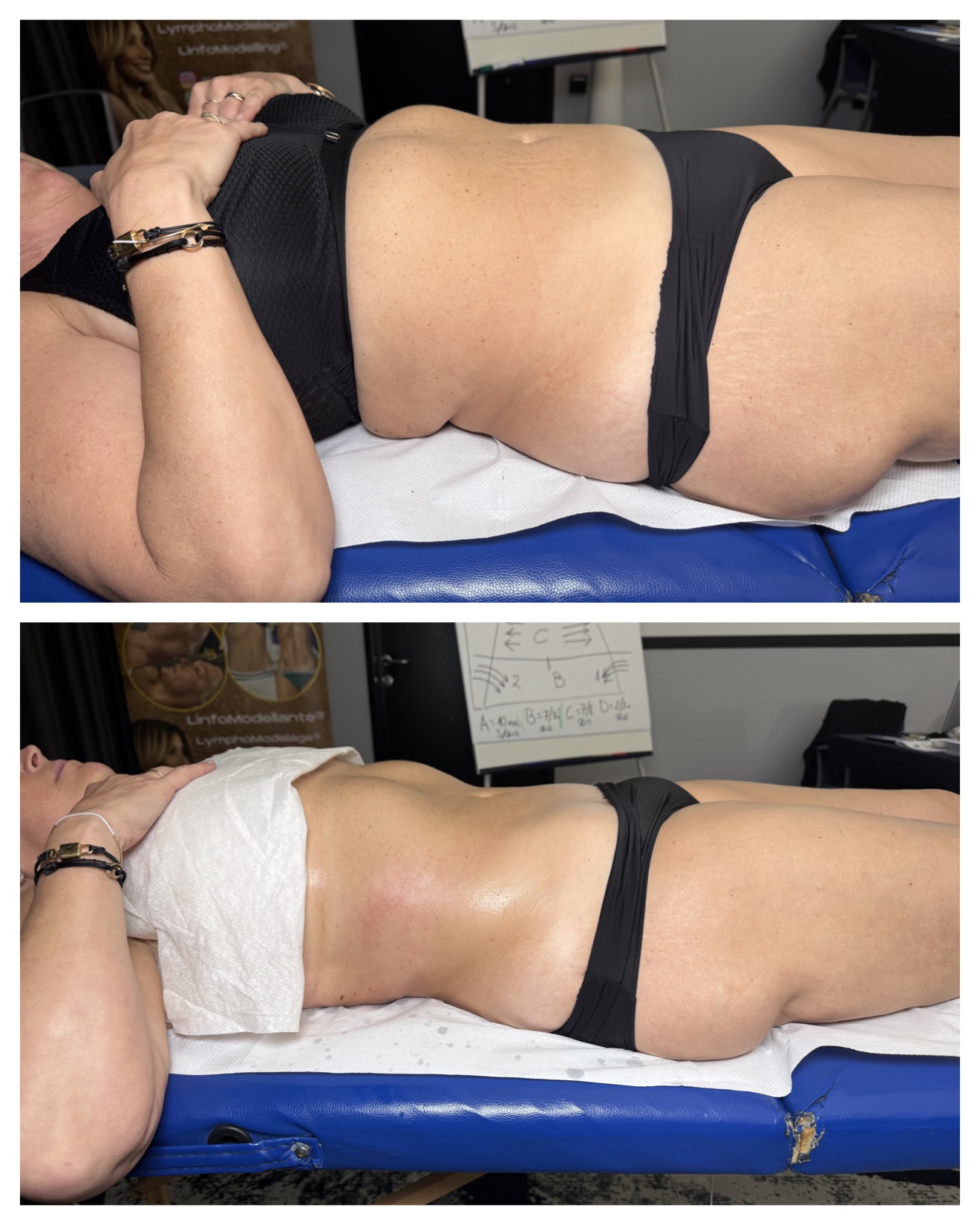 Kateřina Rösslerová - Maderoterapie & Masáže foto 2