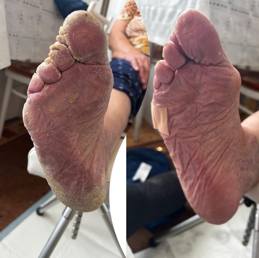 Pedikúra - mobilní i salón foto 2