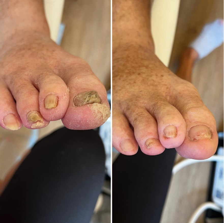 Pedikúra - mobilní i salón foto 4