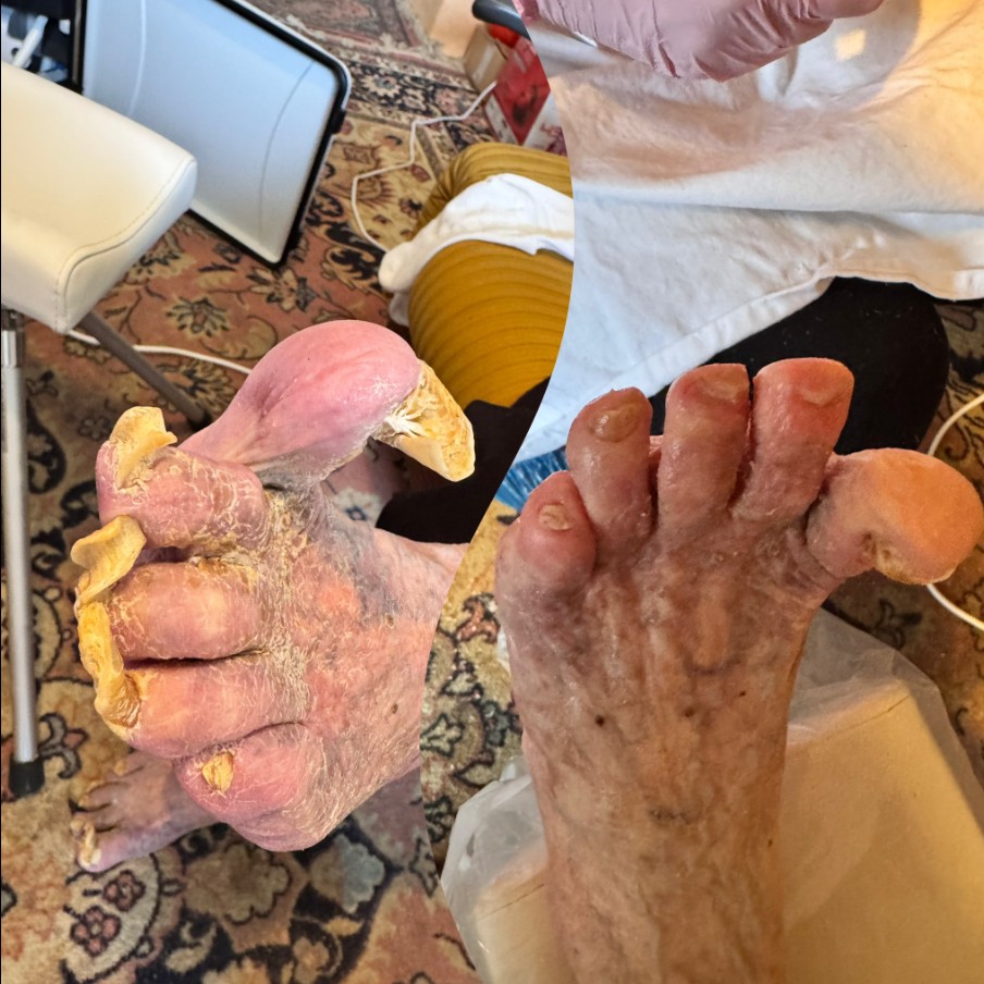 Pedikúra - mobilní i salón foto 6