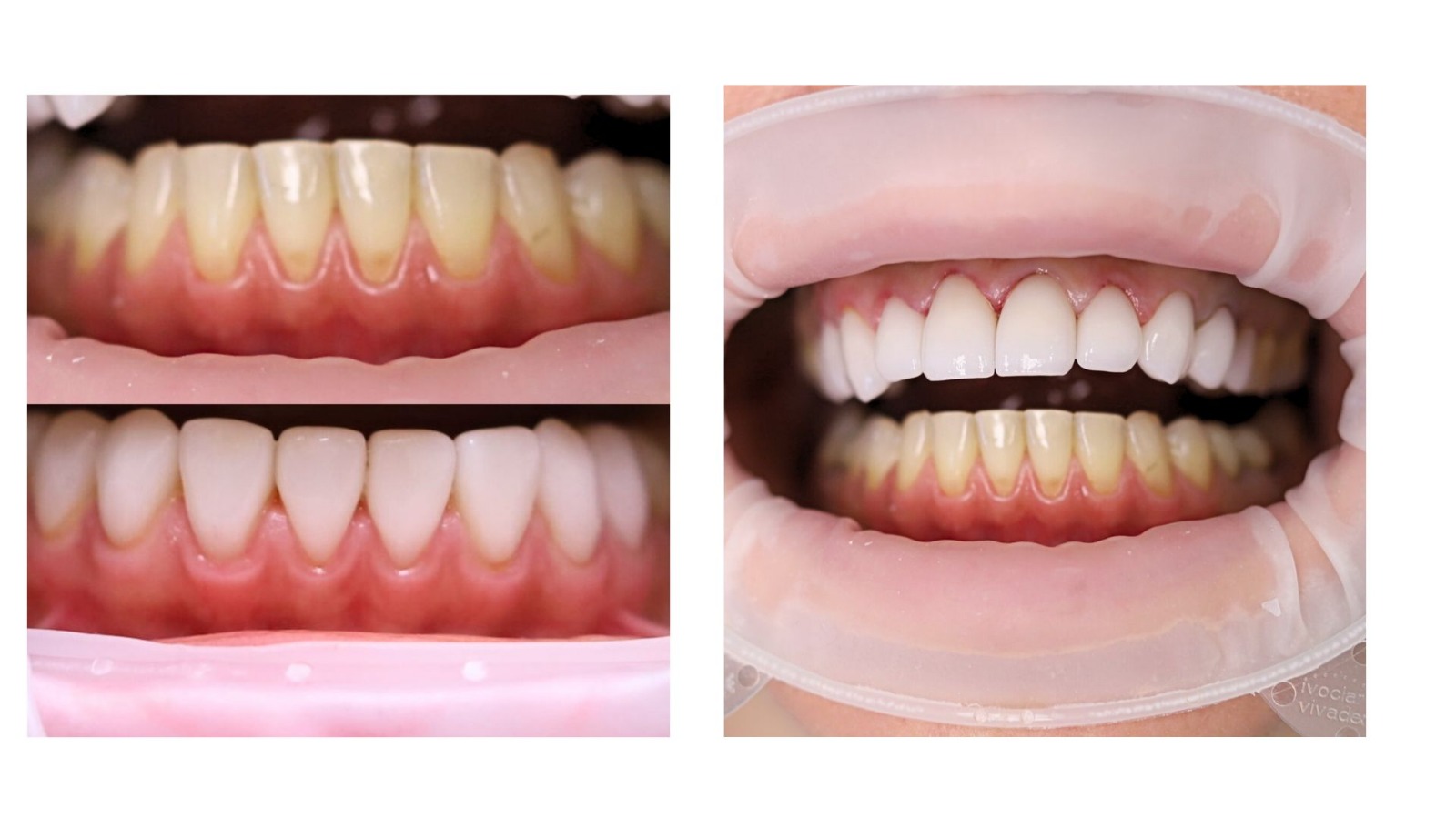 Smile Centrum foto 3