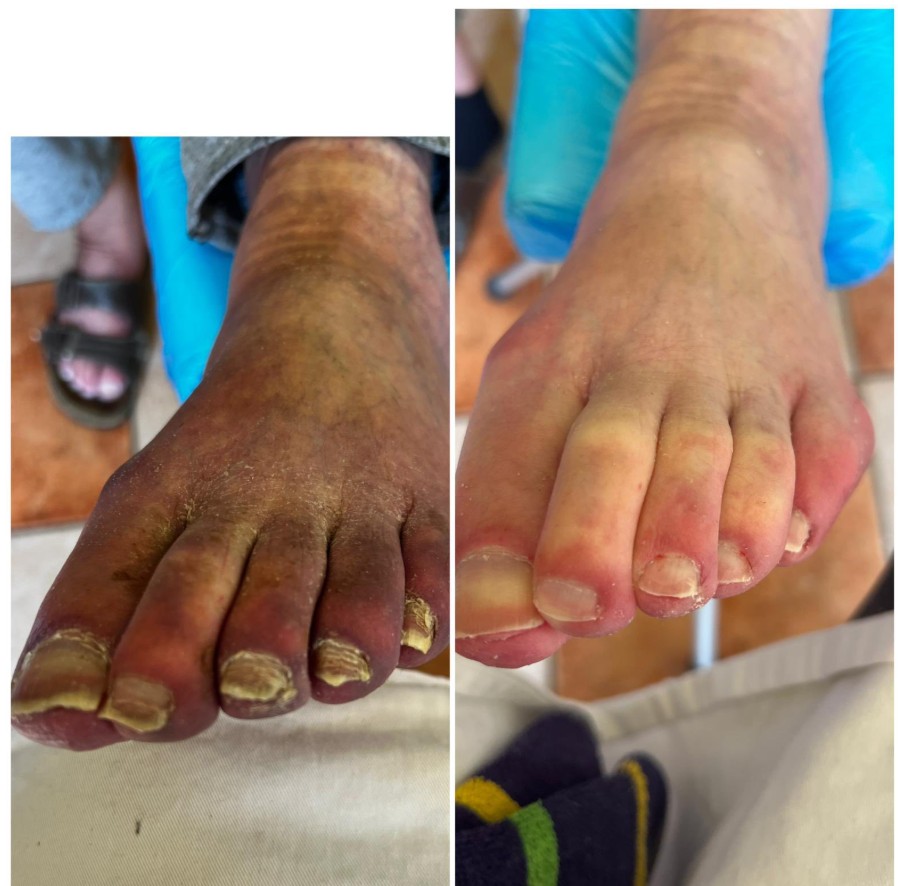 Pedikúra - mobilní i salón foto 3