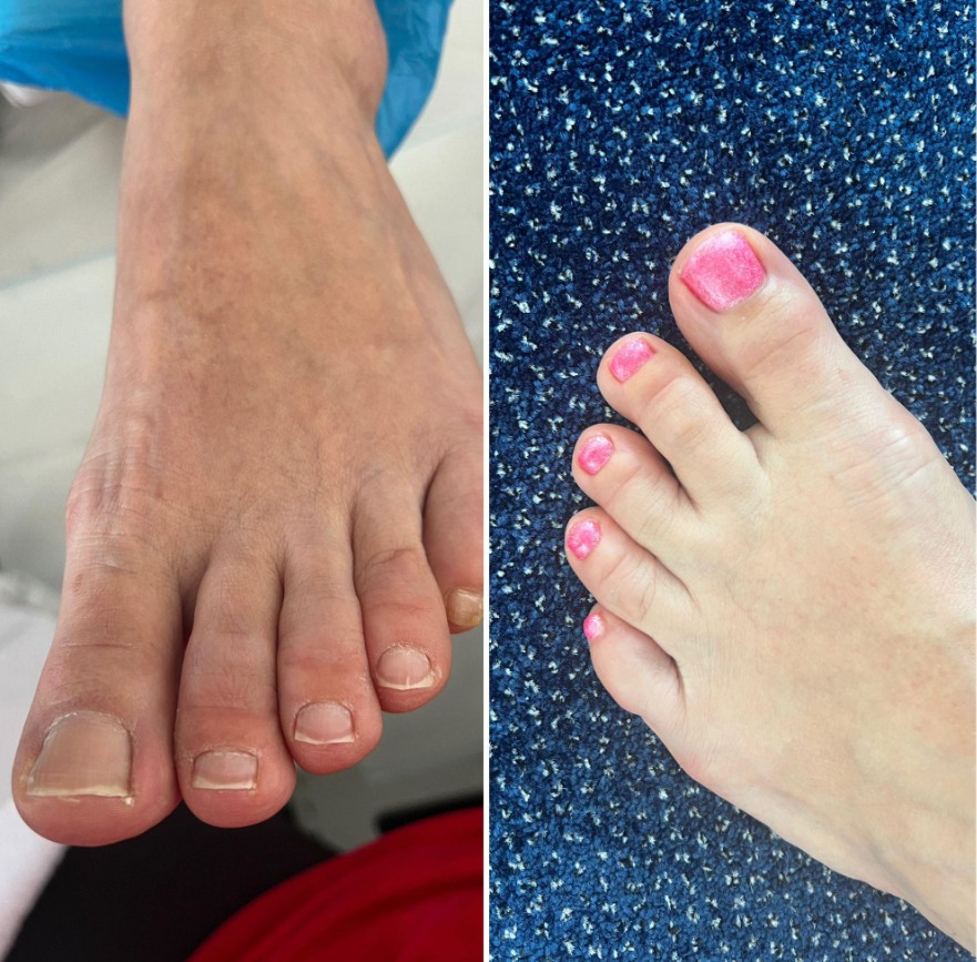 Pedikúra - mobilní i salón foto 5
