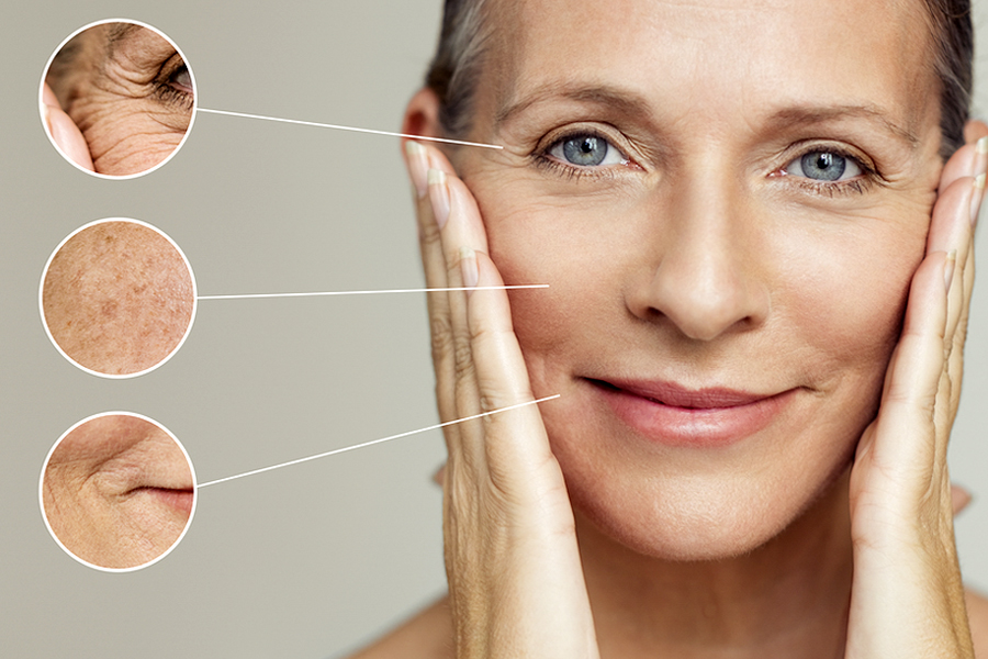 Čas na CHEMICKÝ PEELING