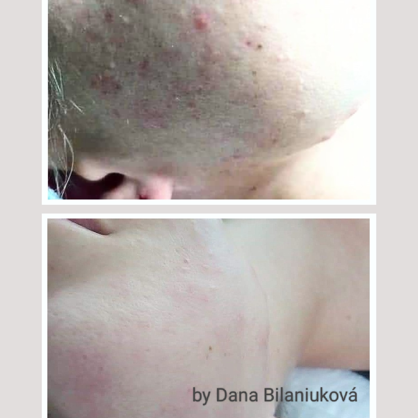 Kosmetický ateliér Srdeční záležitost - Dana Bilaniuková foto 4