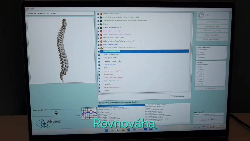 BM Terapie Biorezonance foto 2 (náhled videa)