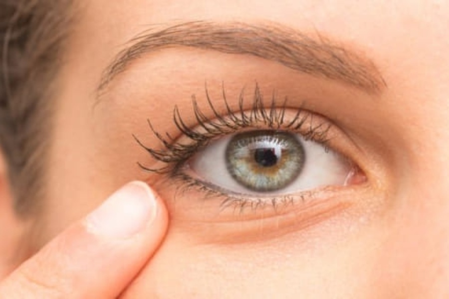 Odstranění kruhů pod očima