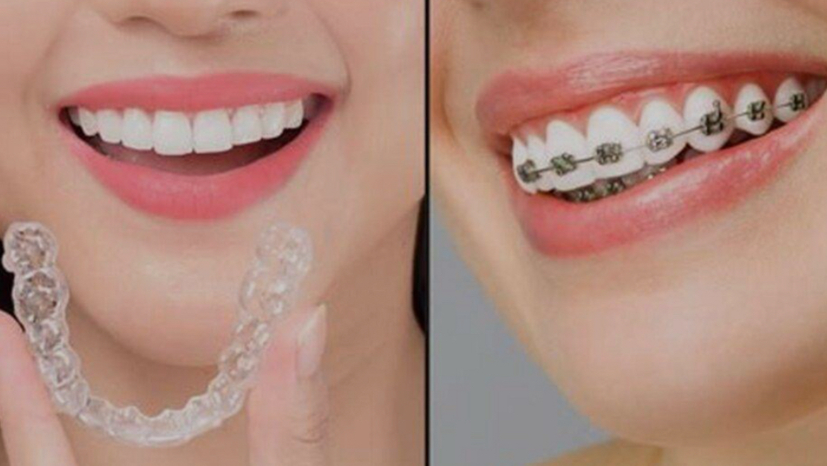 Ortodoncie  - Stomortho s.r.o. foto 2