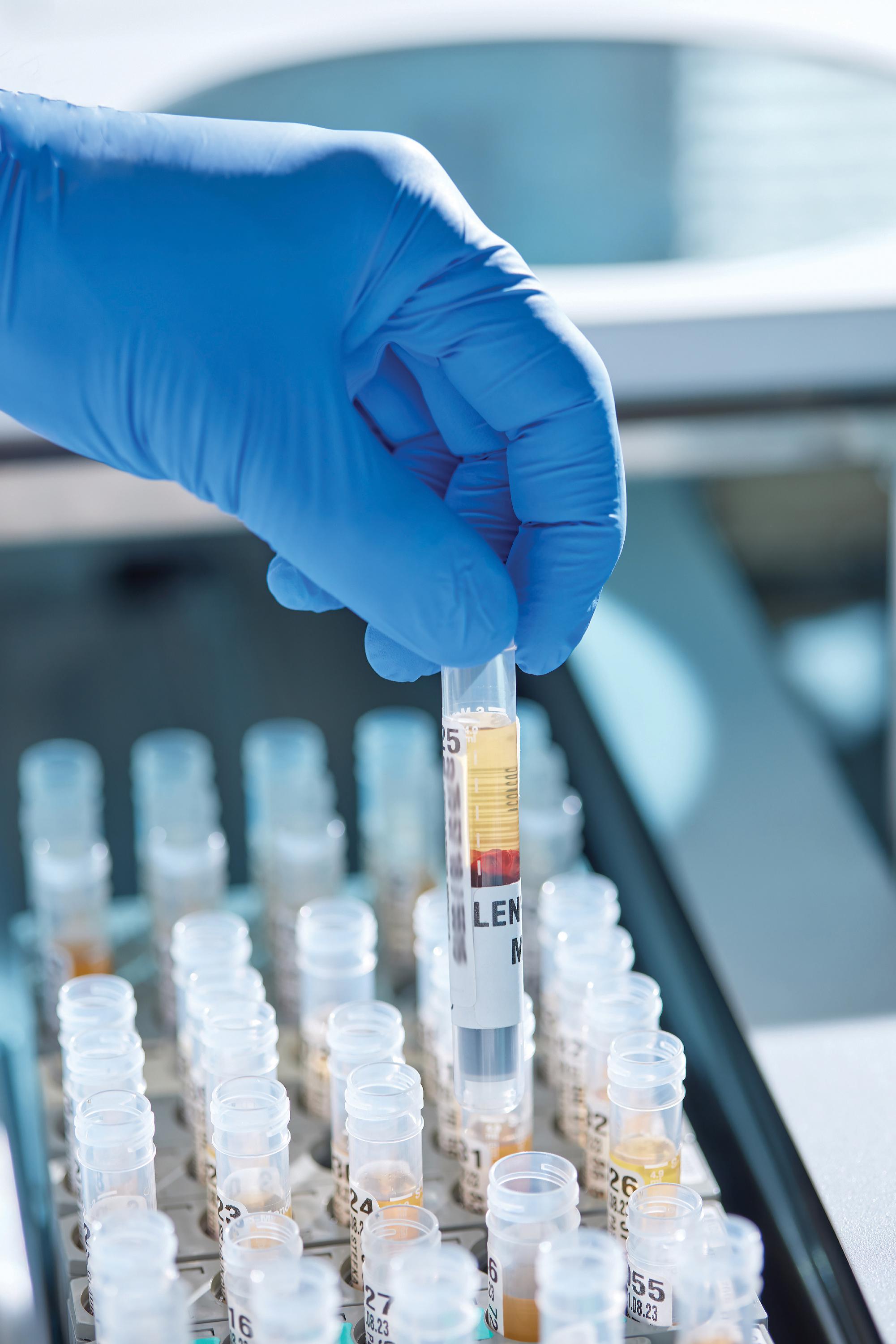 EUC Klinika České Budějovice s.r.o. -  Biochemická laboratoř foto 4