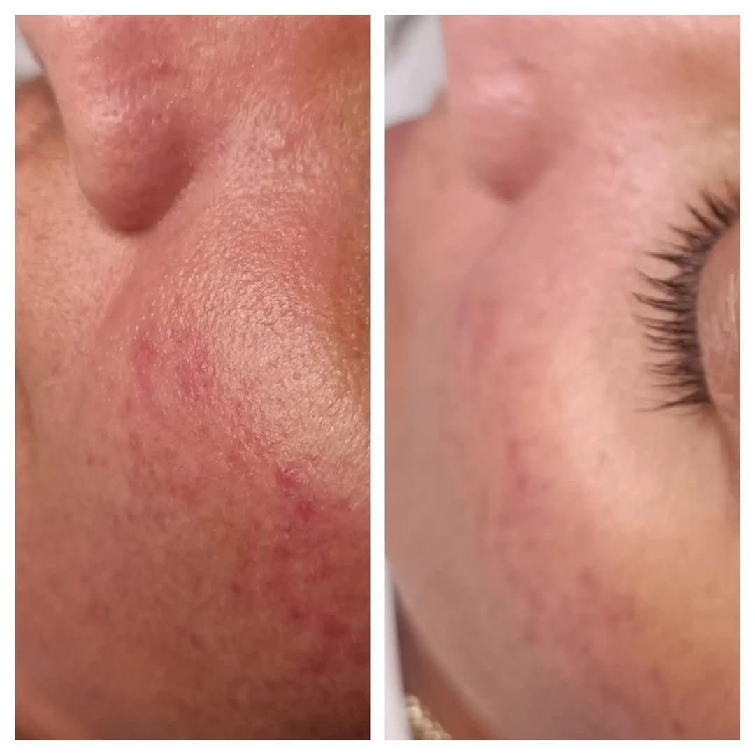 Myidealskin.cz foto 3