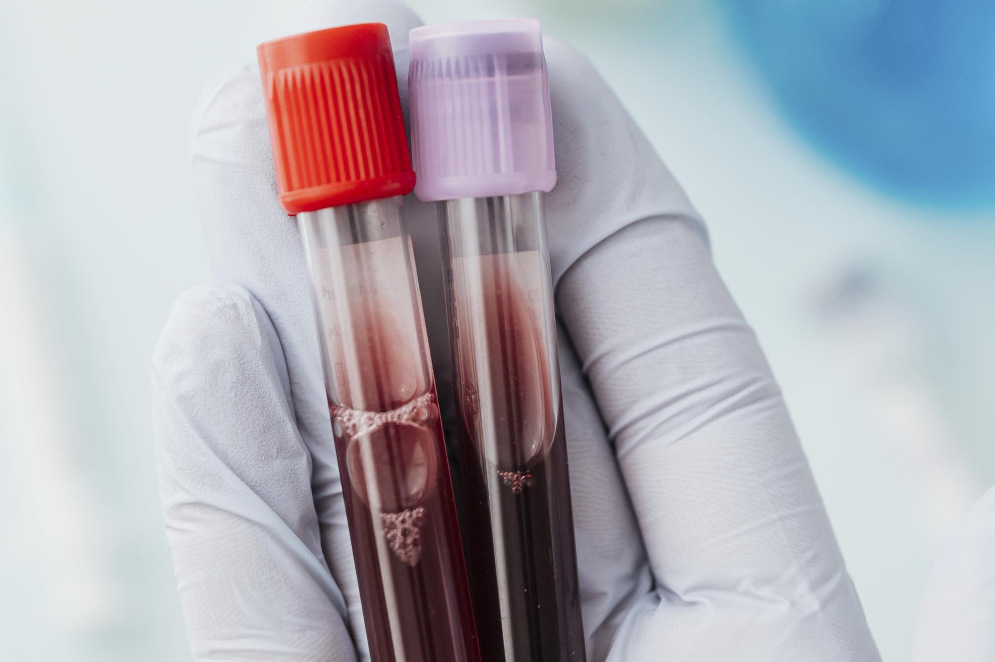 EUC Odběrové místo