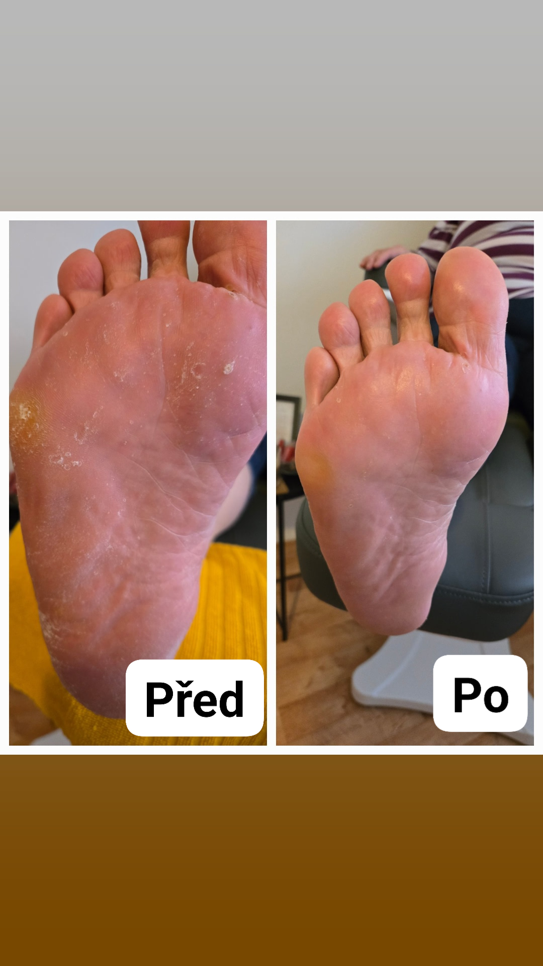 Pedikúra Vlasta foto 3