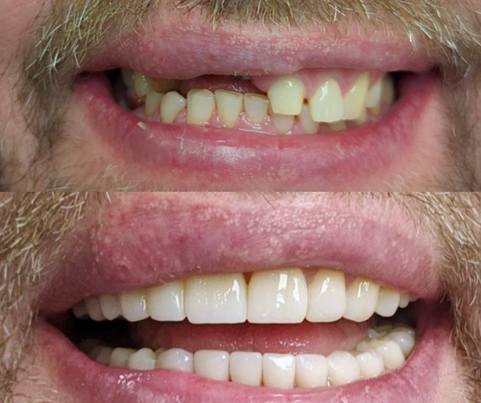 Family Dental Care foto 4