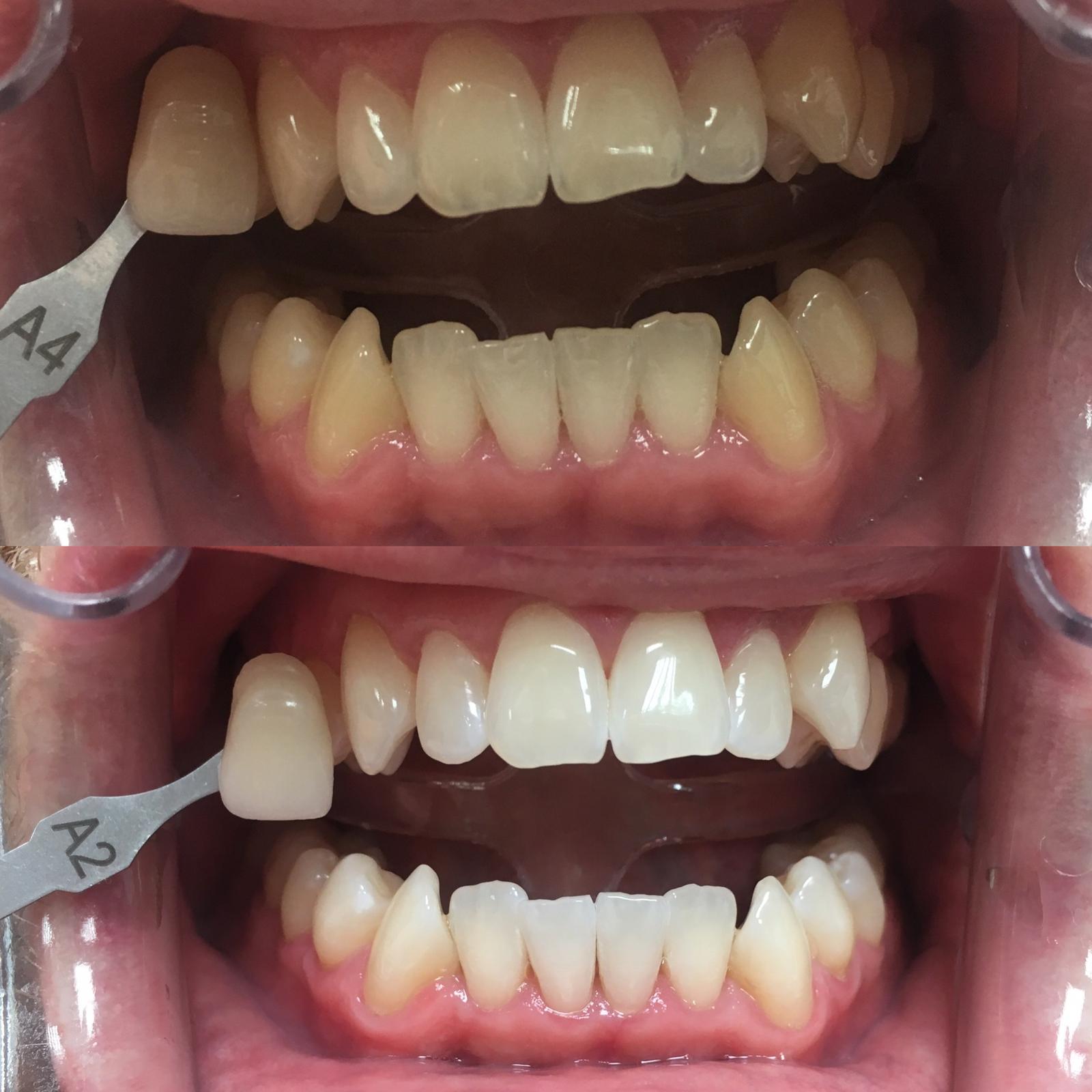 Dentální hygiena Veronika Dušková, DiS. foto 3