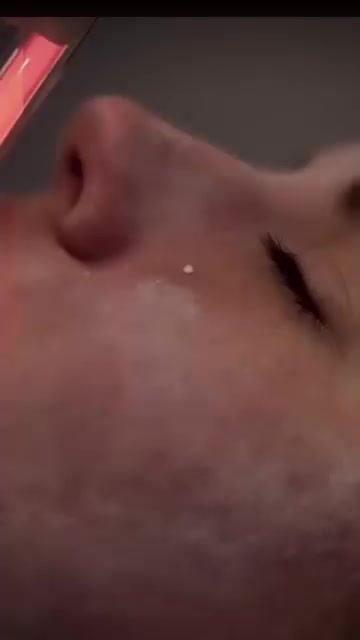 Myidealskin.cz foto 2 (náhled videa)