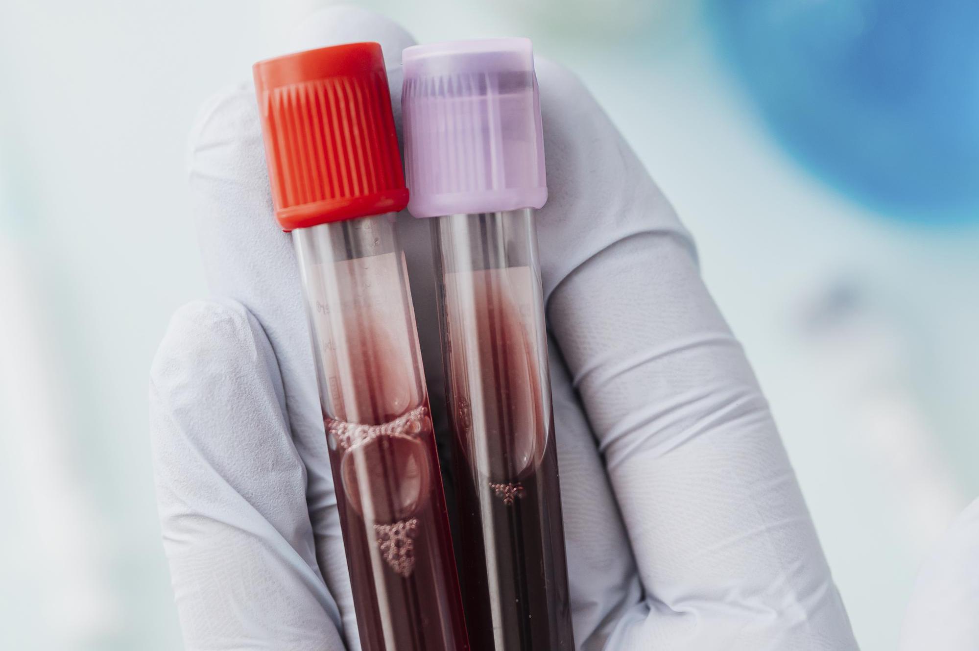 EUC Odběrové místo