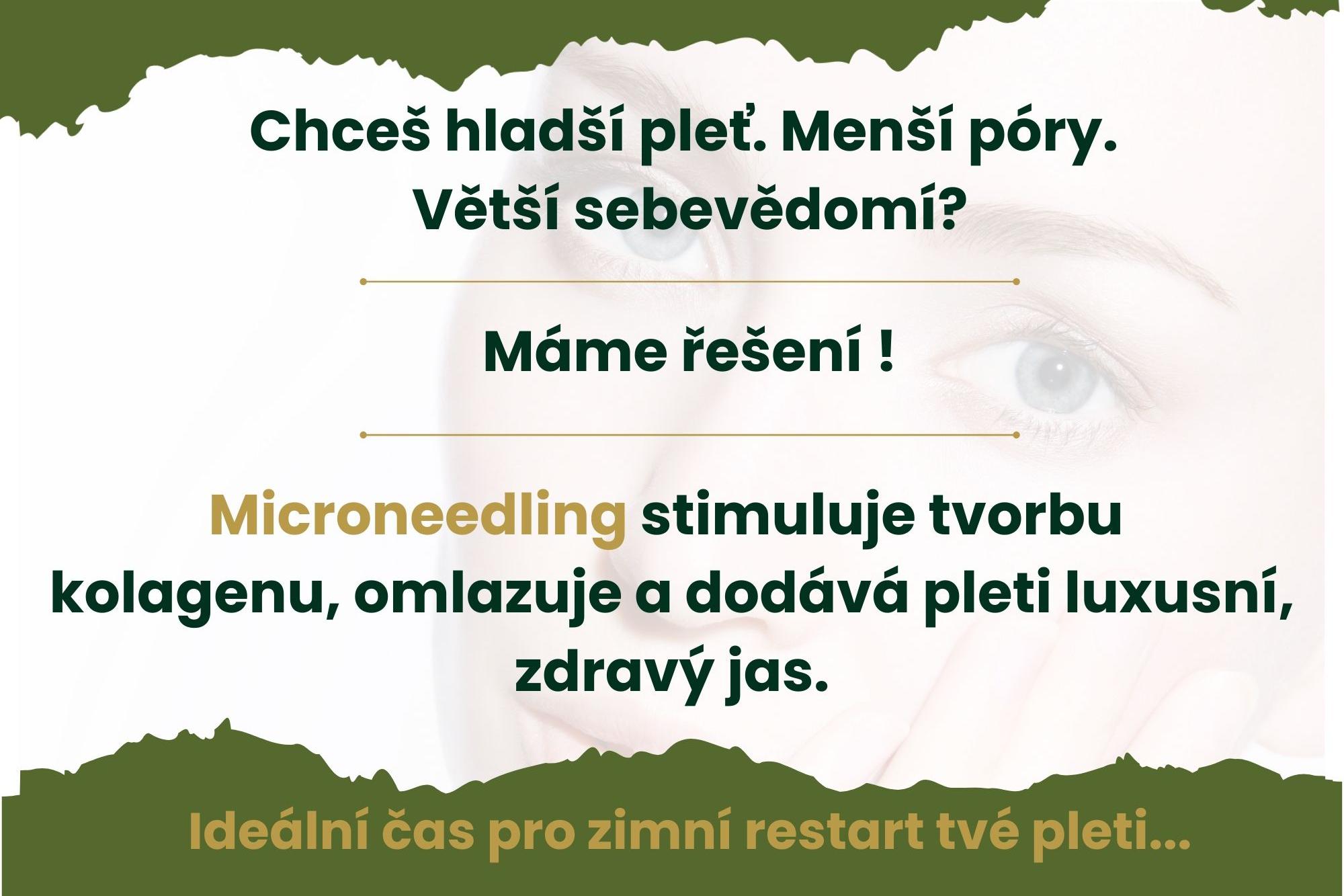 MICRONEEDLING - skvělá zimní procedura