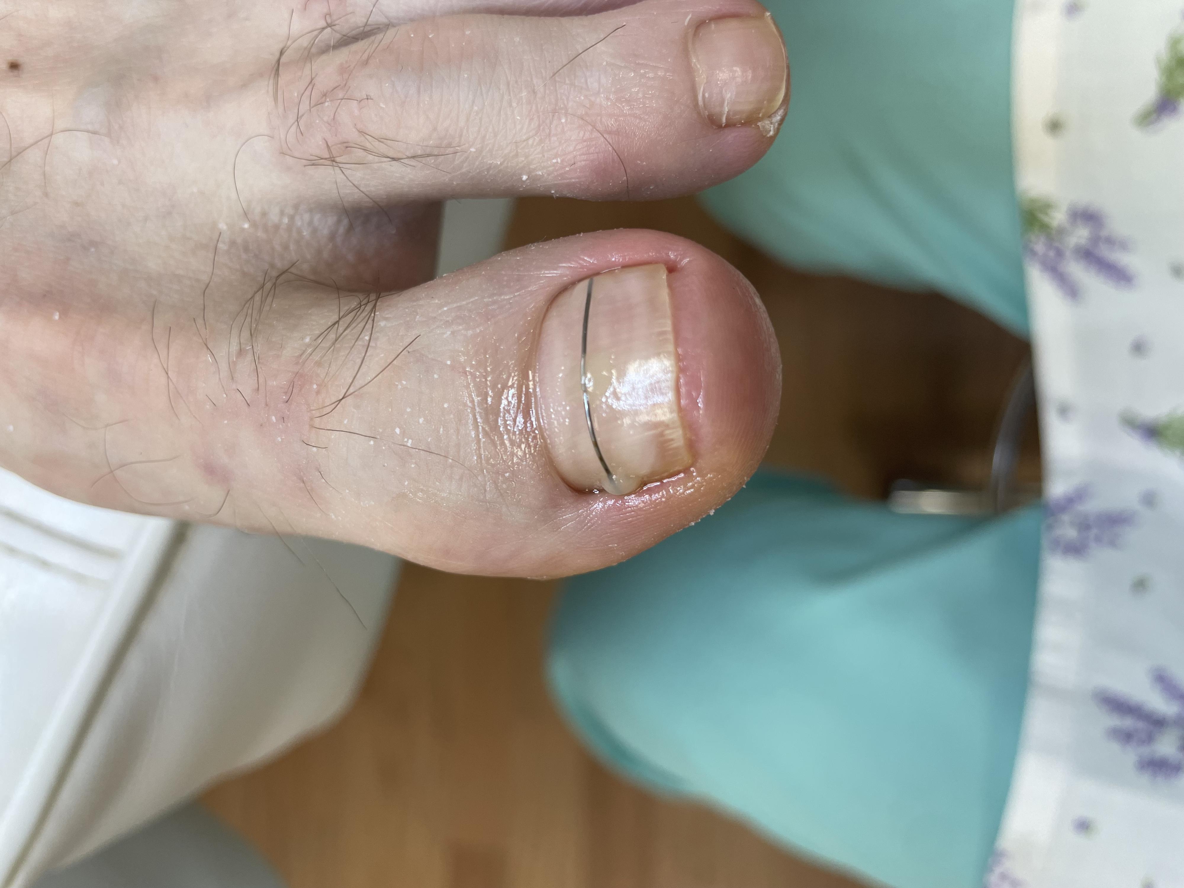 Pedikúra a manikúra - Jitka Tumová foto 4