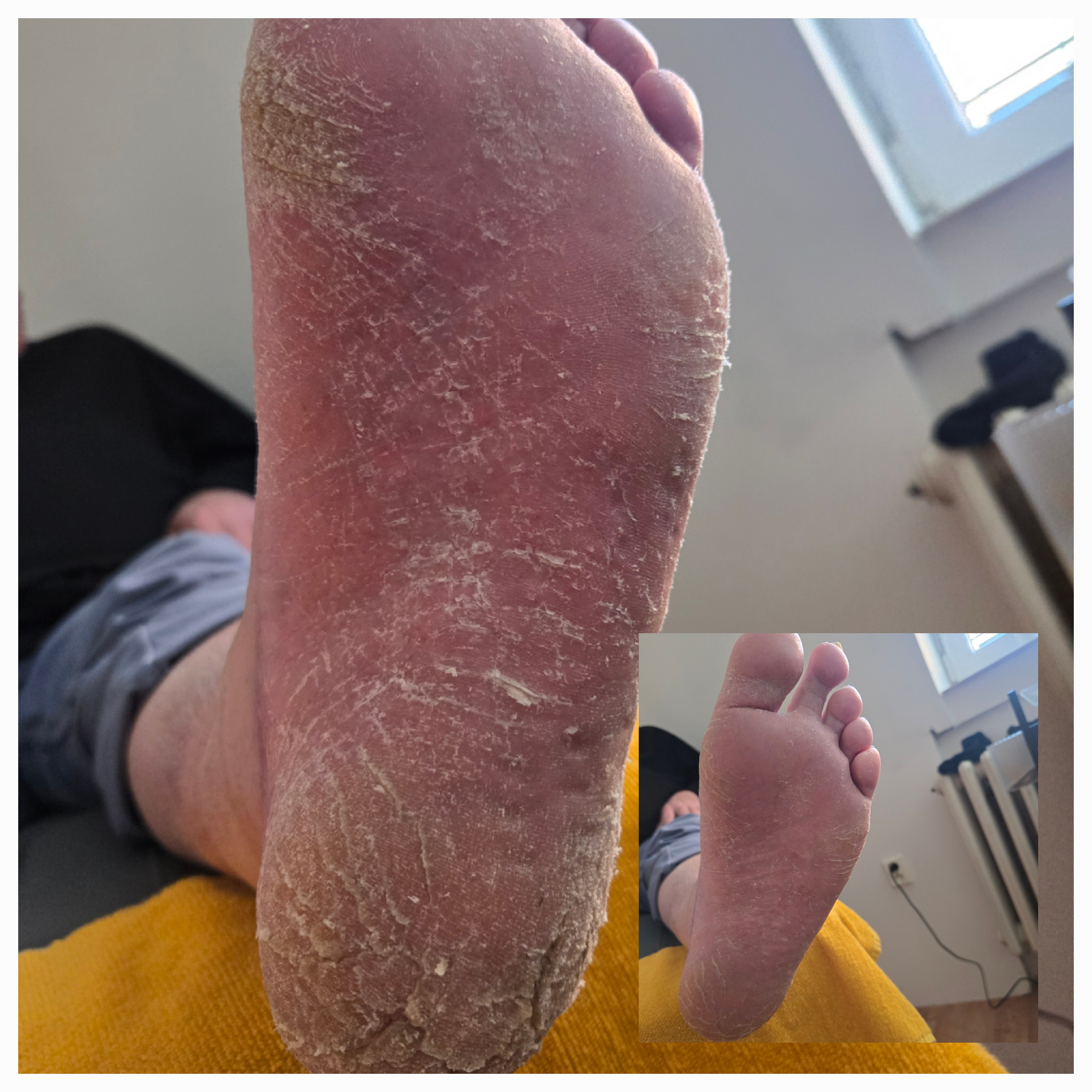 Pedikúra Vlasta foto 2