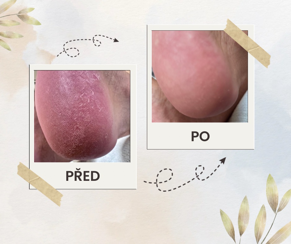 Pedikúra Jana Vocásková foto 3