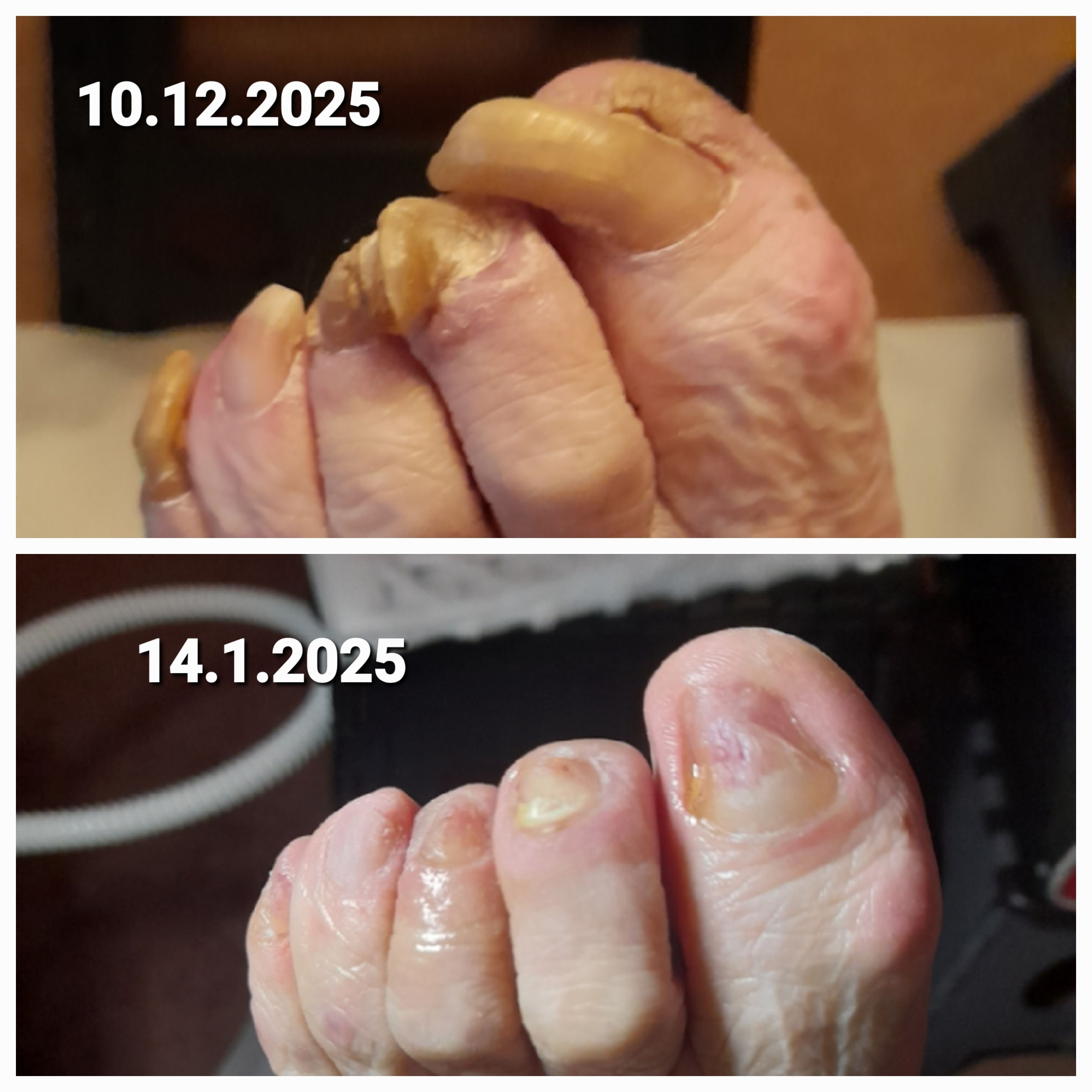 Mobilní pedikúra - Jana Pernicová foto 2