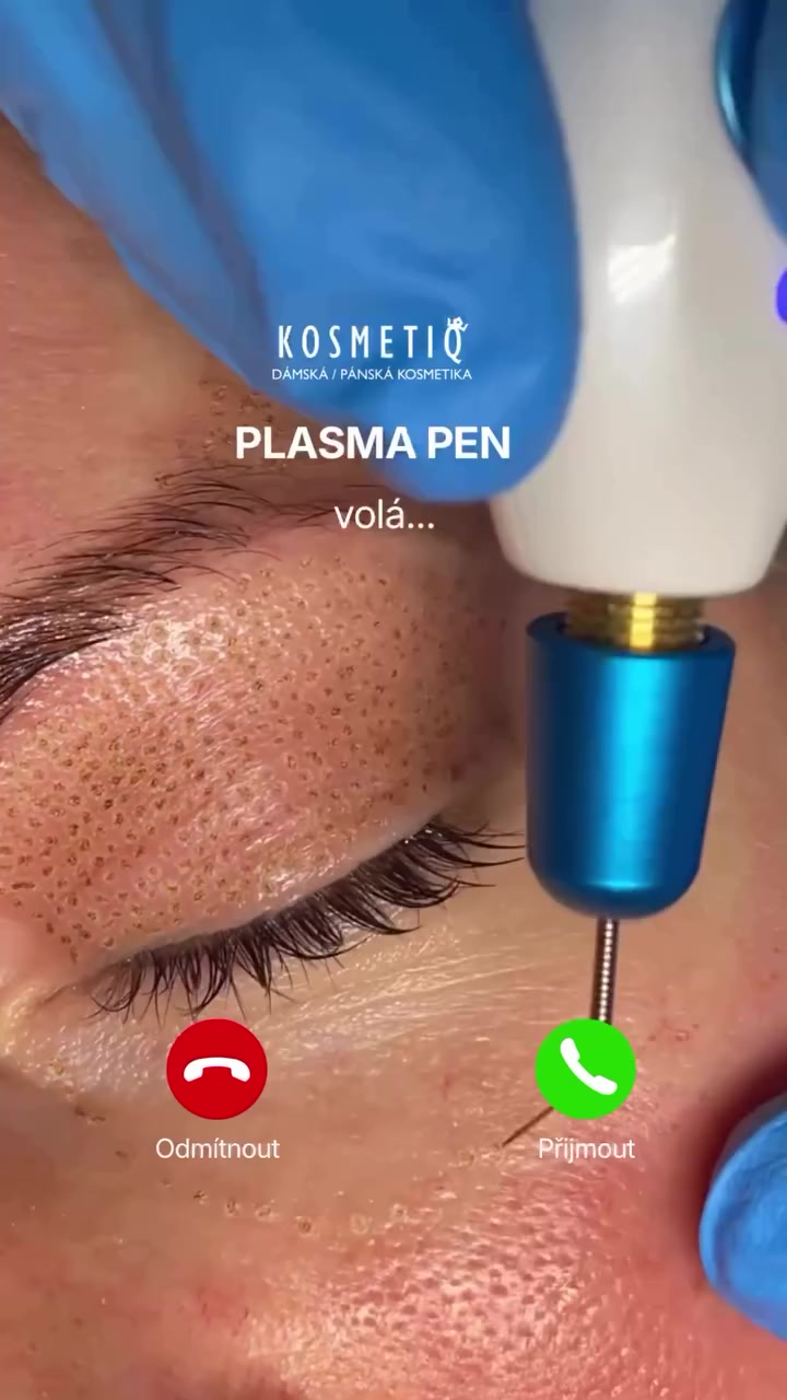 Kosmetiq foto 2 (náhled videa)