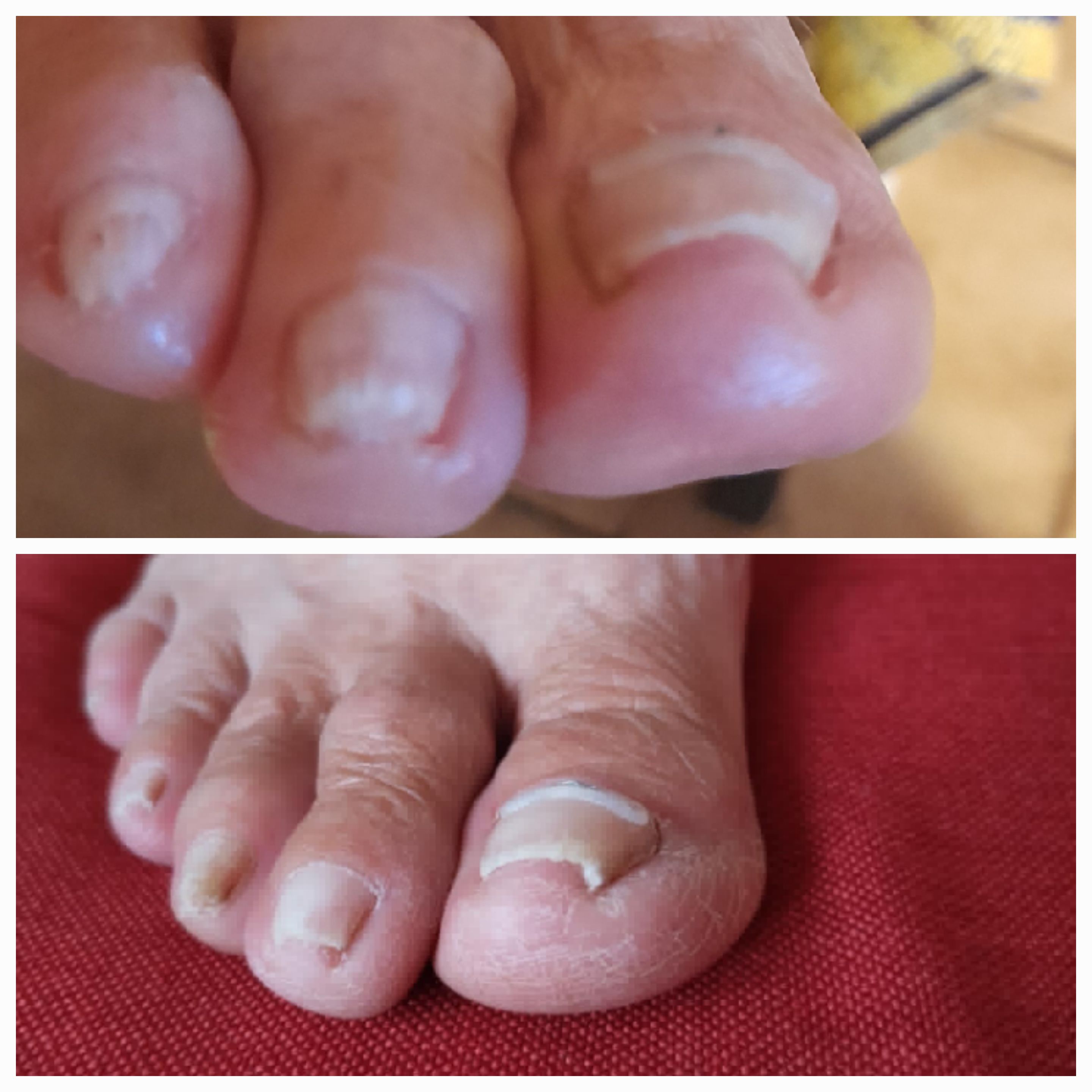 Mobilní pedikúra - Jana Pernicová foto 3